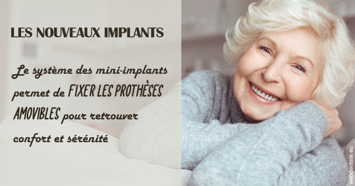 https://dr-prats-cecile.chirurgiens-dentistes.fr/Les nouveaux implants 1