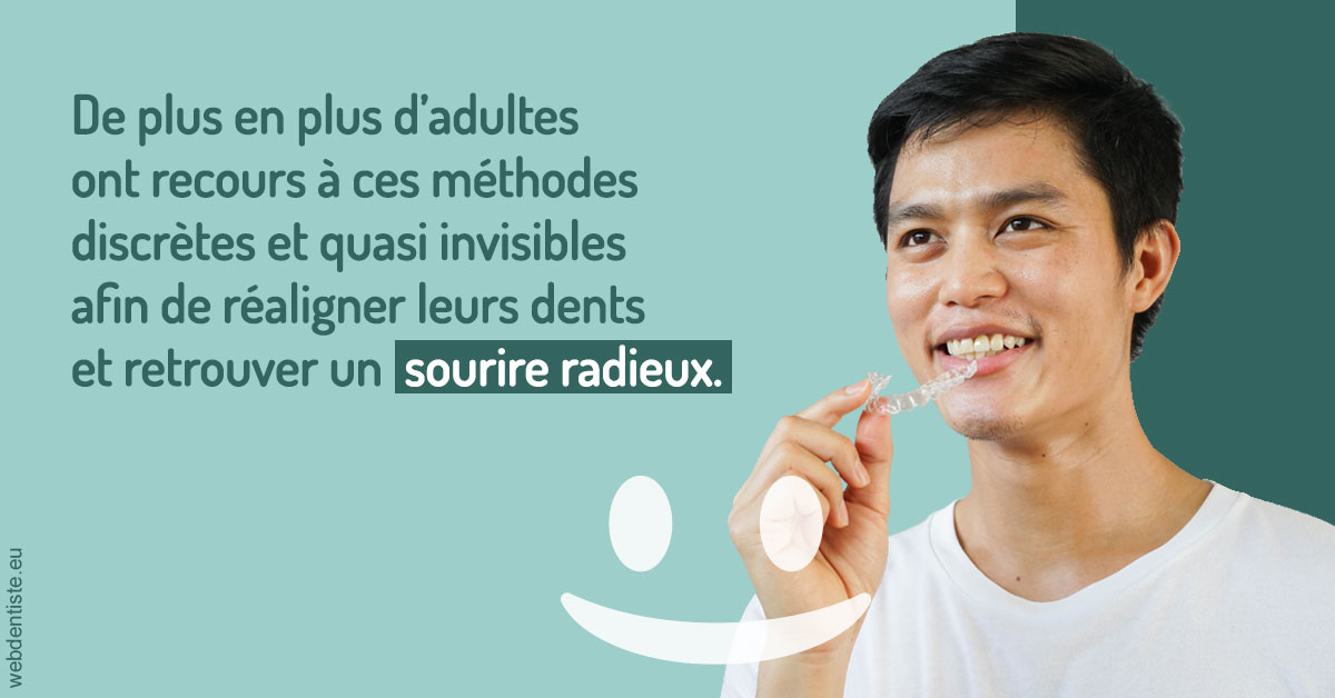 https://dr-prats-cecile.chirurgiens-dentistes.fr/Gouttières sourire radieux 2