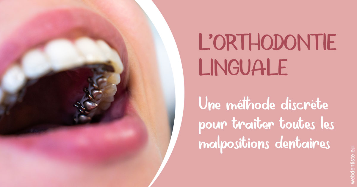 https://dr-prats-cecile.chirurgiens-dentistes.fr/L'orthodontie linguale 2