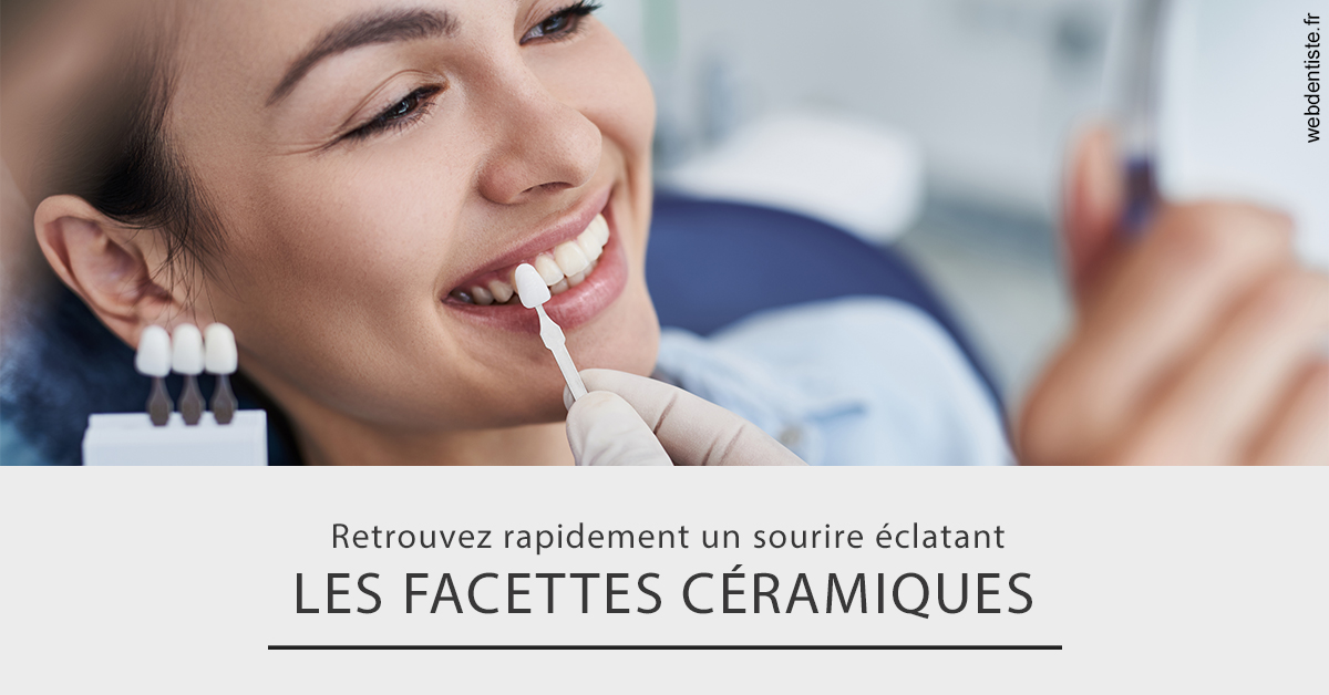 https://dr-prats-cecile.chirurgiens-dentistes.fr/Les facettes céramiques 2