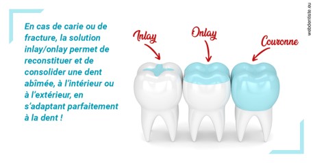 https://dr-prats-cecile.chirurgiens-dentistes.fr/L'INLAY ou l'ONLAY