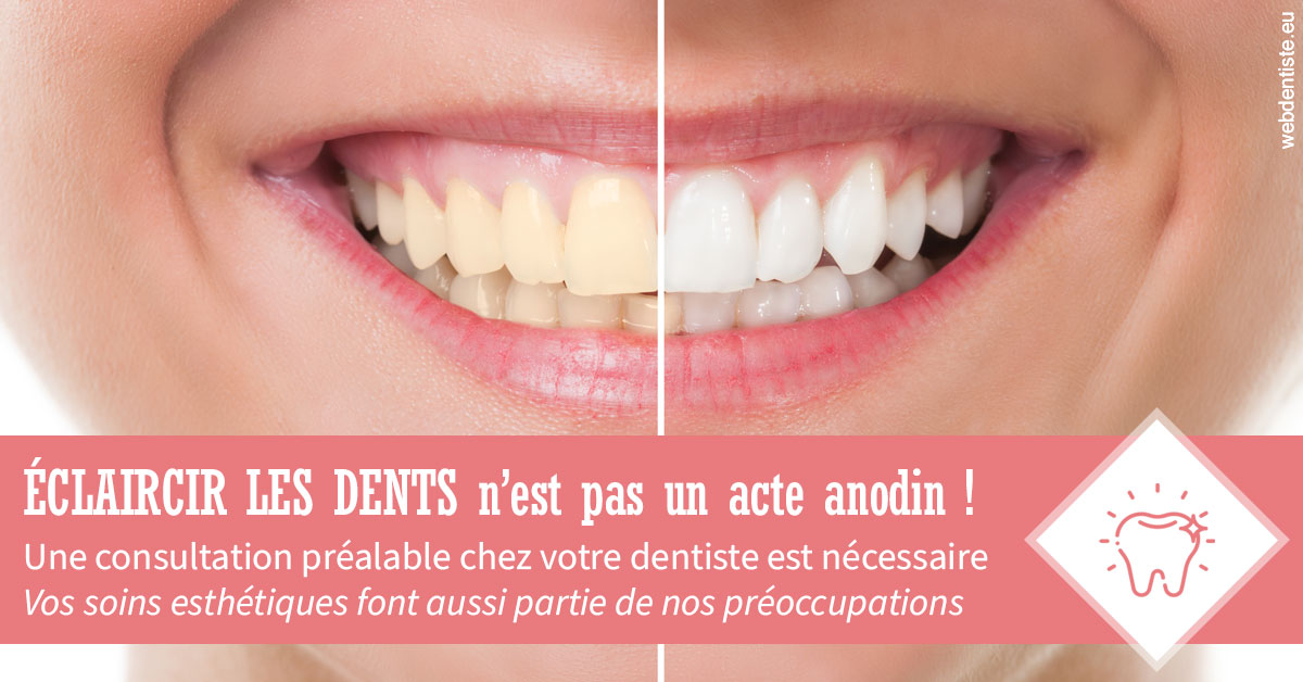 https://dr-prats-cecile.chirurgiens-dentistes.fr/Eclaircir les dents 1