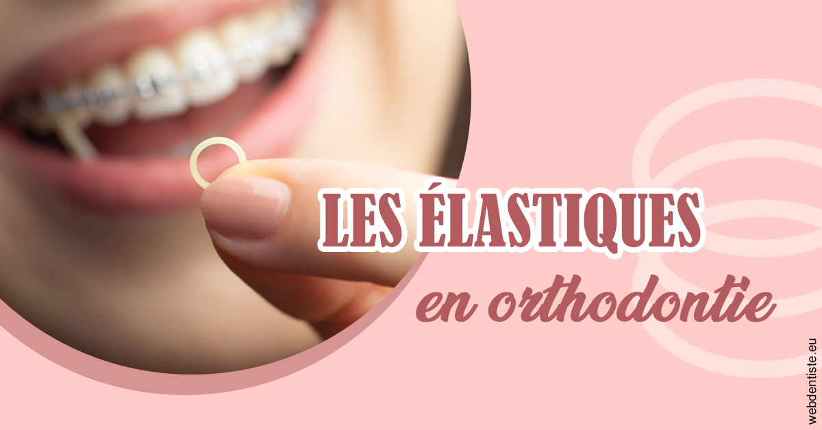 https://dr-prats-cecile.chirurgiens-dentistes.fr/Elastiques orthodontie 1