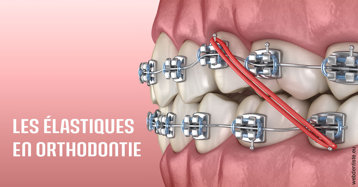 https://dr-prats-cecile.chirurgiens-dentistes.fr/Elastiques orthodontie 2