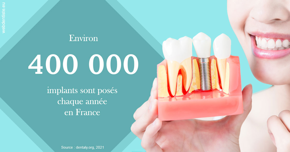 https://dr-prats-cecile.chirurgiens-dentistes.fr/Pose d'implants en France 2